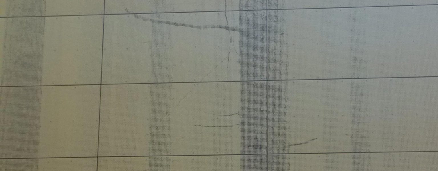 Alu-Motiv-Lochblech-genietet_7